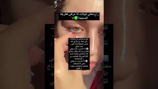 علاج أكثر شيء نعاني منه✨ الهالات السوداء تحت العينين 💕 [upl. by Bindman594]