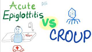 Acute Epiglottitis Vs Croup  A Detailed Comparison [upl. by Yemirej]