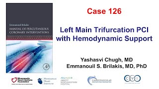 Case 126 PCI Manual  Trifurcation left main PCI [upl. by Lelia]