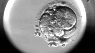 Timelapse of fertilisation of a human egg under the microscope [upl. by Llerdnek]