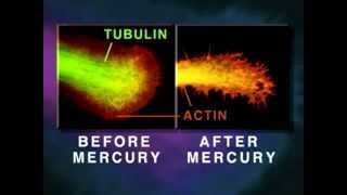 How Mercury Causes Brain Neuron Degeneration  University Of Calgary [upl. by Demha]