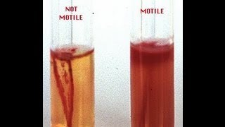 Motility Determination in Bacteria  Amrita University [upl. by Llerrom]