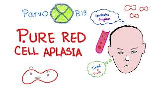 Pure Red Cell Aplasia PRCA  Parvo B19 Virus  Hematology [upl. by Ringo777]