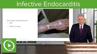 Infective Endocarditis IE Definition amp Epidemiology– Infectious Diseases  Lecturio [upl. by Lynnelle158]