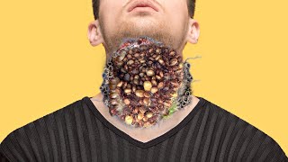 ASMR Removes Large Pustules amp Parasitic Maggots on neck  2d Animation [upl. by Utley]