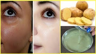 SKIN WHITENING Overnight Permanently  Apply it Before Sleeping  FAIR SPOTLESS amp GLOWING SKIN [upl. by Elleinnad]