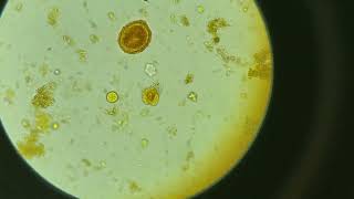 Huevo de Ascaris lumbricoides y quiste de Entamoeba coli en una muestra de heces [upl. by Annekam]