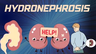 HYDRONEPHROSIS  Pathophysiology Causes signs and symptoms background diagnosis and treatment [upl. by Elayor]