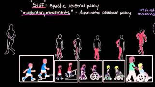 Khan Academy  Types of Cerebral Palsy Part 2 Dyskinetic amp Ataxic [upl. by Darrey]