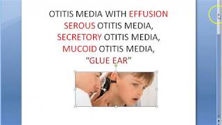 ENT Glue Ear Ottitis Media With Effusion Child Serous Secretory Mucoid [upl. by Agni]