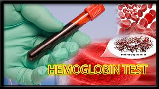 Hemoglobin Blood test  HGP   Harib diagnostic lab [upl. by Atled]