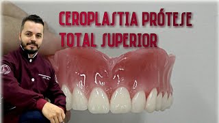 Ceroplastia de uma protese total superiorpasso a passo [upl. by Launamme]