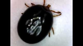 Engorged Tick Magnified [upl. by Willa228]