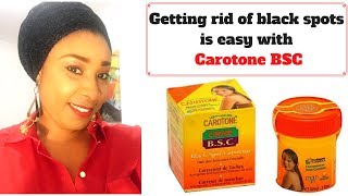 Carotone black spot Corrector review Fade off black spots quickly [upl. by Ruddie379]