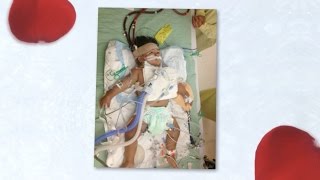 SEPTIC SHOCK 2 YEAR OLD ECMO SURVIVOR [upl. by Conni]