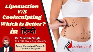 Which is better cool sculpting or liposuction in Hindi  Cool Sculpting  Liposuction [upl. by Dulcle]