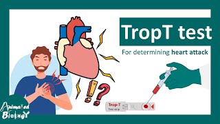 TropT test  What if Trop T test is positive  Troponin T blood test [upl. by Adyeren]