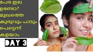 Day 3how to remove pimples amppimplemarks naturally at homemalayalam skincareseries [upl. by Eidnyl]