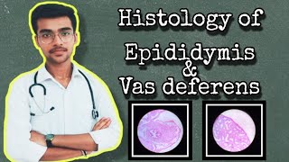 2 Histology of epididymis amp vas deferens  short notes  by Aniket tyagi [upl. by Ikoek]