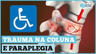 TRAUMA RAQUIMEDULAR O QUE É  O QUE FAZER [upl. by Adnylg3]