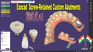 exocad implant design  ScrewRetained Custom Abutments Design in exocad 🦷 [upl. by Fulvia]