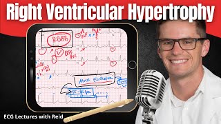 Right Ventricular Hypertrophy RVH EKG  ECG Lecture [upl. by Cleavland348]