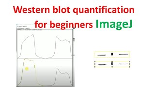 Quantification of western blot using imageJ for beginners  western blot quantification  imagej [upl. by Delgado]