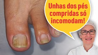 ALÍVIO AO CORTAR AS UNHAS DOS PÉS [upl. by Euginom]