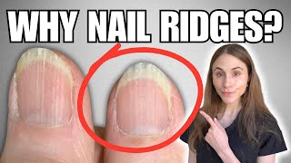 Why You Have Vertical Nail Ridges And How To Get Rid Of Them [upl. by Dermott778]