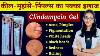 Clindamycin and Niacinamide gel uses benefits dose side effects  Clinsol gel  Clindamycin gel [upl. by Immas969]