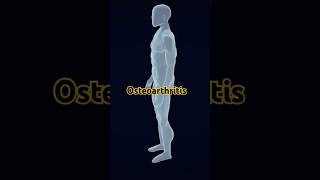 Osteoarthritiscausestreatment osteoarthritis viralshorts 3danimation crazypharmaguruji [upl. by Akehsal]