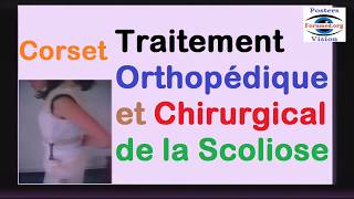 Traitement Orthopédique Corset Chirurgical et kinésithérapie de la Scoliose [upl. by Nedyah238]