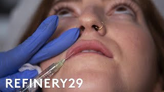 I Got Lip Filler Injections For The First Time  Macro Beauty  Refinery29 [upl. by Falconer]