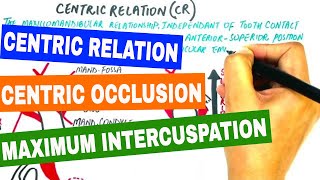 Centric Relation Centric Occlusion amp Maximum Intercuspation [upl. by Nonad]