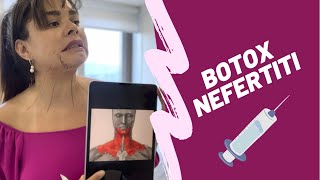 BOTOX NEFERTITI EFEITO LIFTING [upl. by Yelreveb921]