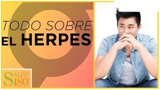 Herpes síntomas y tratamiento  Salud180 [upl. by Caldera331]