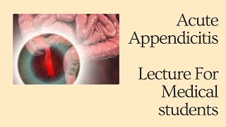 Acute Appendicitis  Lecture for Medical Students mbbs neet usmle fmge neetpg [upl. by Nnyled]