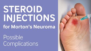 Mortons neuroma steroid injection complications [upl. by Dareece]