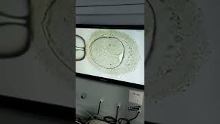 making a embryo with ICSI ivf embryo microscope RKSmicroscopicworld [upl. by Goff]