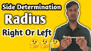 Radius Bone Side determination Right or left 🤔🤔🤔 Hindi English [upl. by Nysilla278]