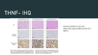 ENDOCRINOLOGÍA  Tumores Hipofisiarios No Funcionantes [upl. by Ycak]