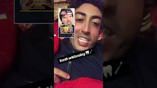 Teeth whitening 🦷🦷💔💔 orthodonticbraces duet dentisty teethbraces dentist dentistdoctor [upl. by Animaj]