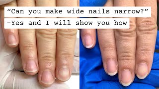 How to make wide nails more narrow [upl. by Kwang571]