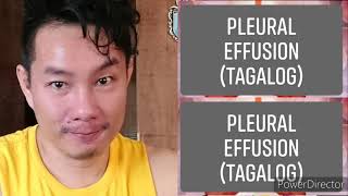 Pleural Effusion Tagalog [upl. by Baiel]