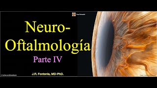 Clase de Neuroftalmologia Parte IV [upl. by Sherlock]