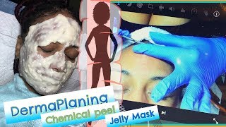 Curing acne with anitaging Facials  Dermaplaning Part 1 [upl. by Mariko414]