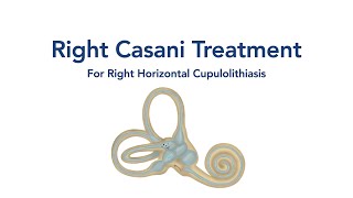 At Home Right Casani Treatment for BPPV Vertigo [upl. by Primrose234]