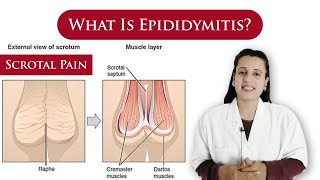 What is Epididymitis  causes symptoms treatment  scrotal pain  By Dr N Joshi [upl. by Anailil]