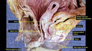 3Female pelvic organs 34 [upl. by Atikim]