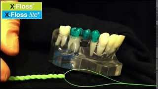 Hygienist shows how to floss IMPLANTS and BRIDGES [upl. by Izabel]